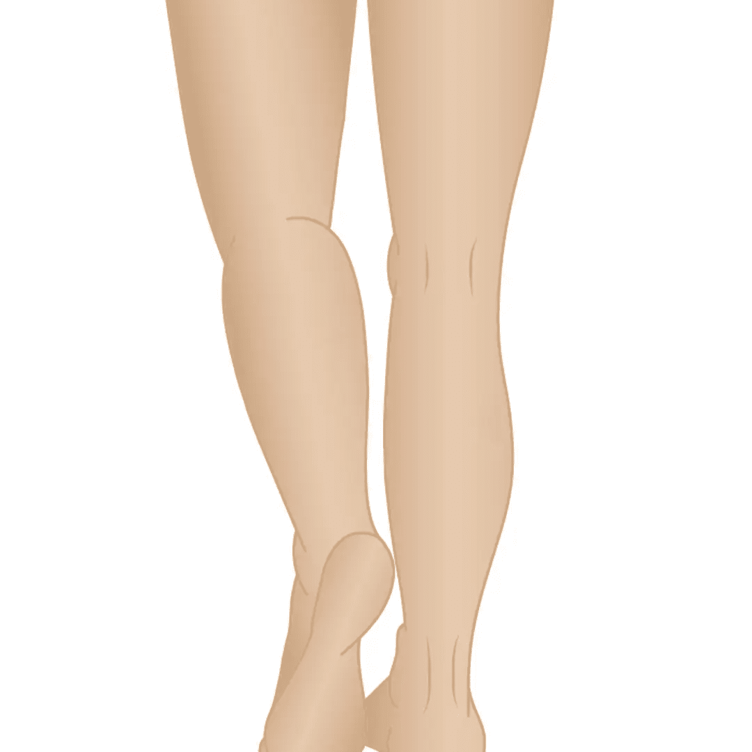 Leg Lengthening Surgery Cost With Insurance