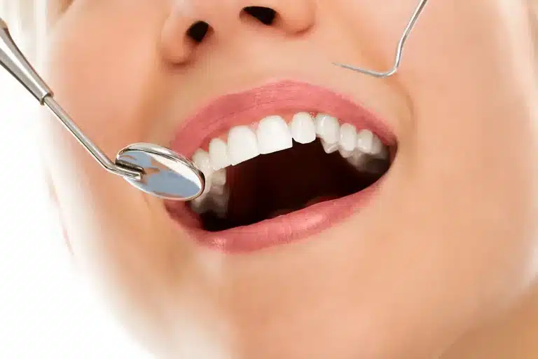 Cheapest Countries for Dental Work in the World