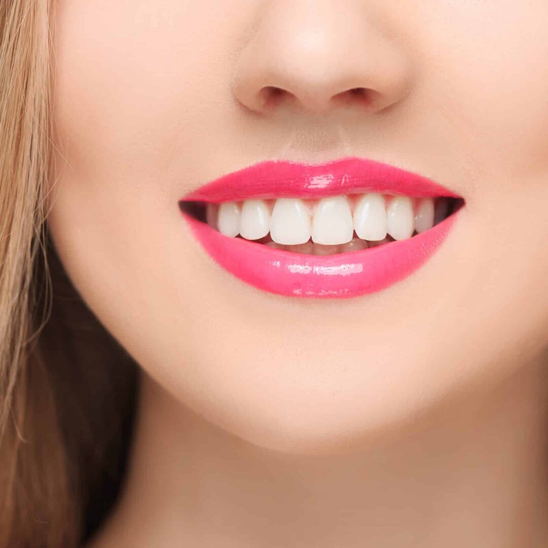 Full Mouth Dental Veneers in Mexico Cost