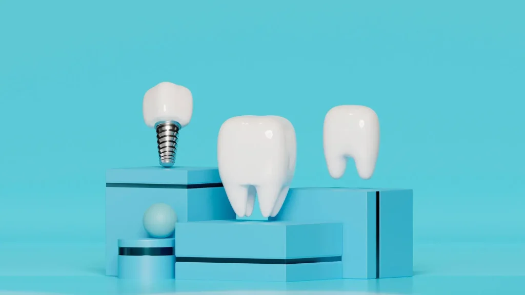 Top 10 Dental Implant Companies in the World