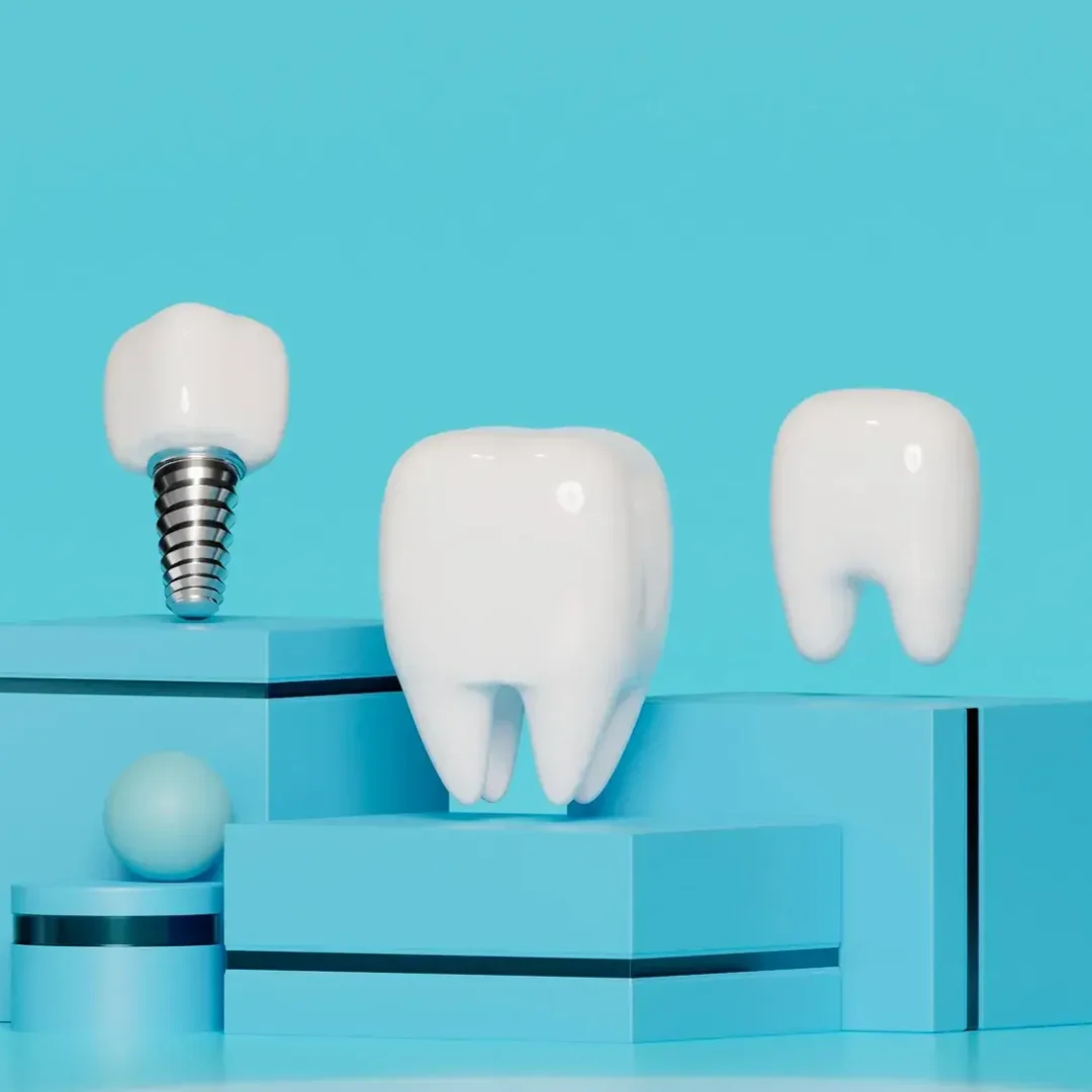 Top 10 Dental Implant Companies in the World