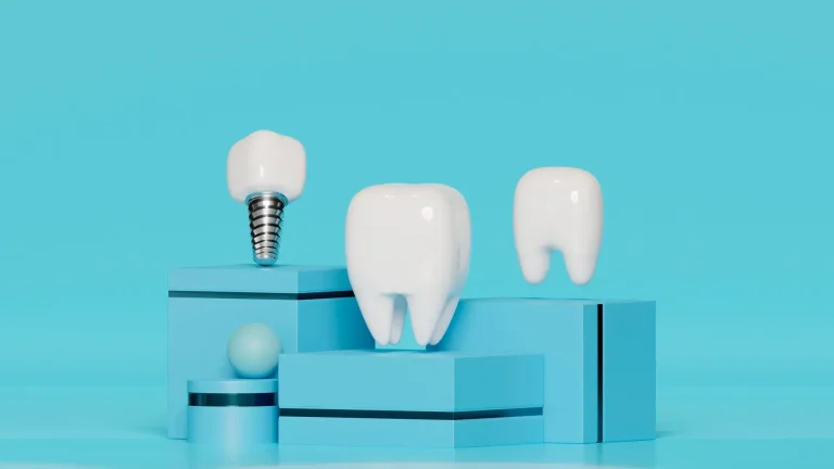 Top 10 Dental Implant Companies in the World