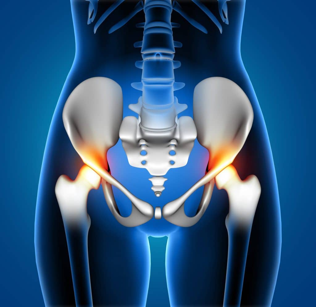 3D medical illustration of female spine and hip pain