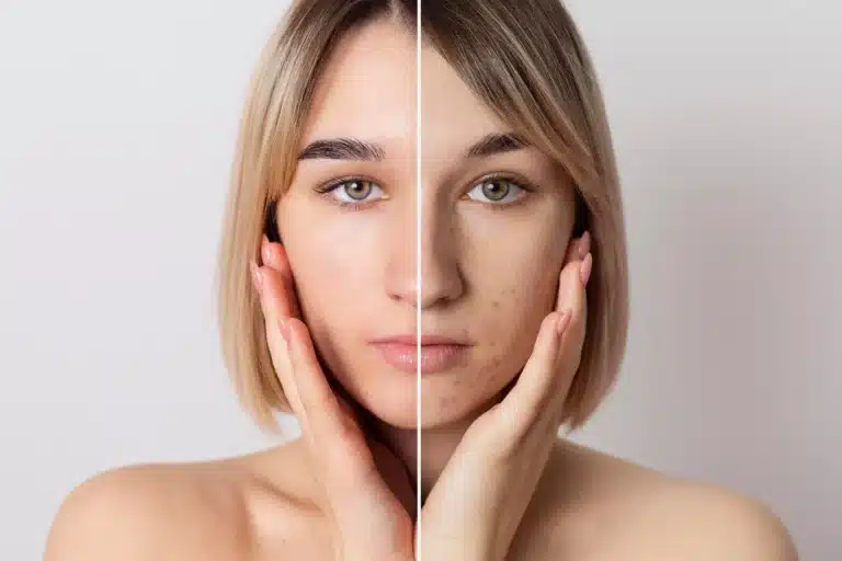 Skin Lightening in Korea Cost with Clinics