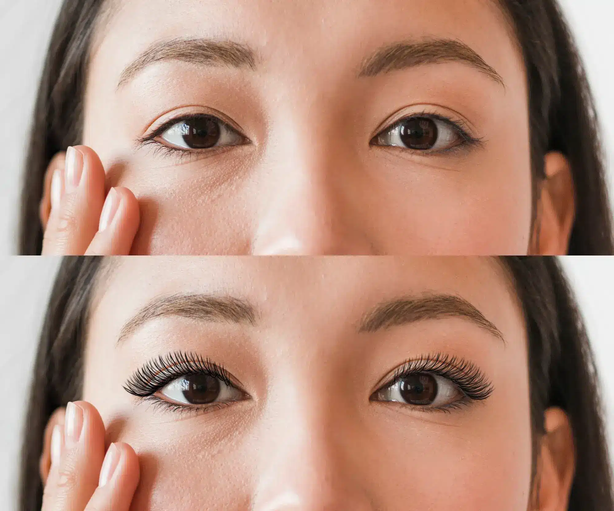 韩国隆鼻和亚洲式双眼皮手术后5周: r/PlasticSurgery, image size:2000x1664