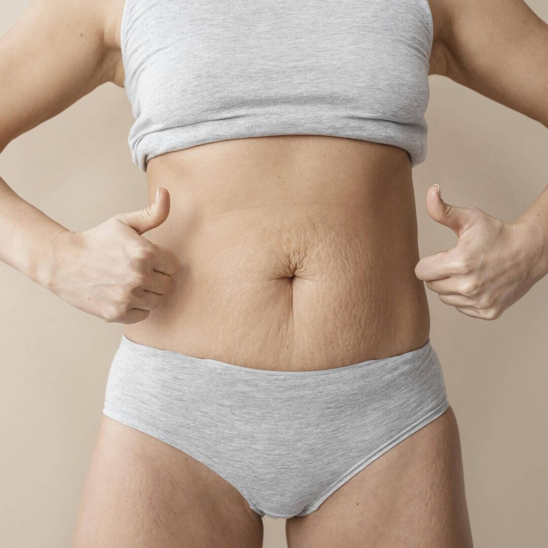 Cheapest Countries for Tummy Tuck Surgery in the World