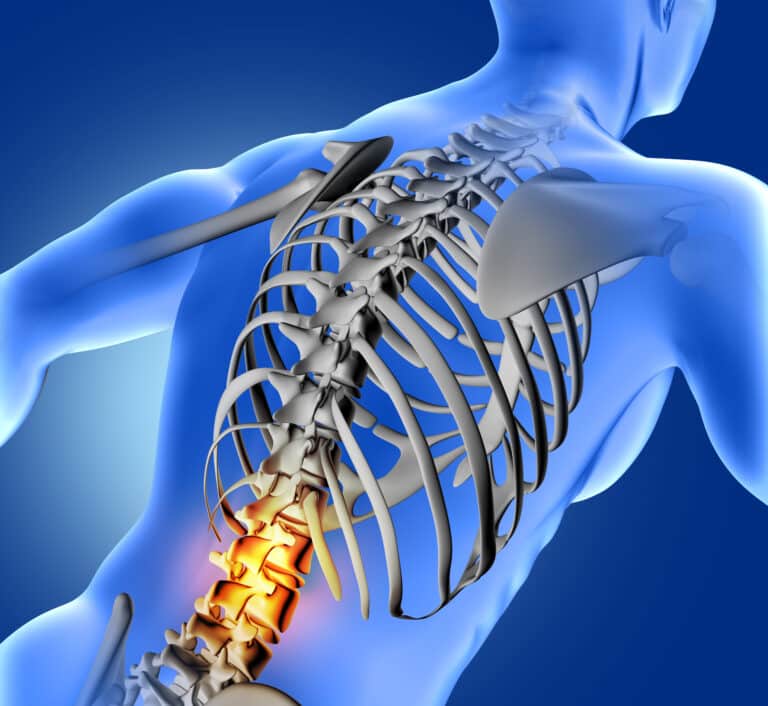 Spine surgery in Turkey cost