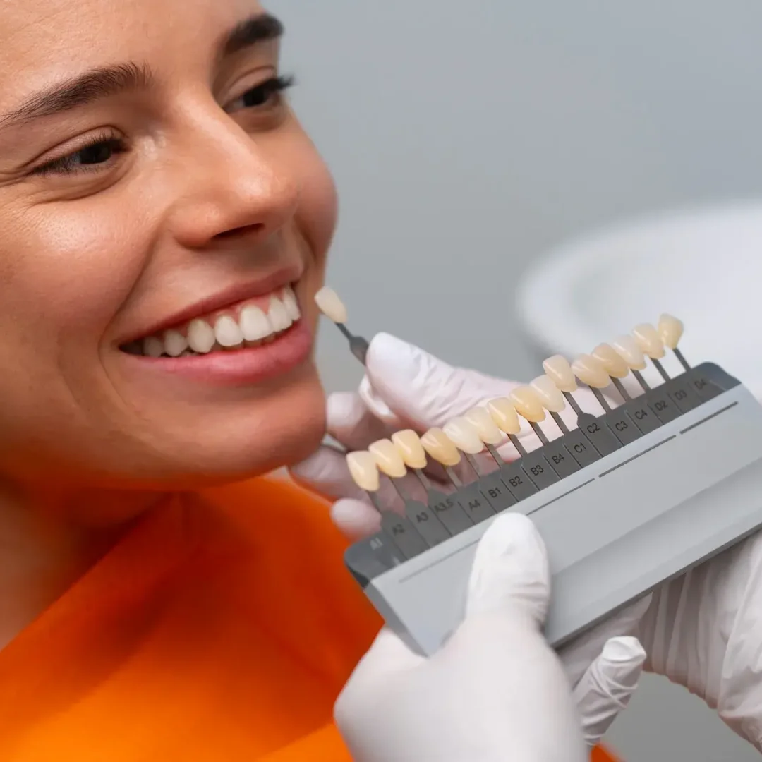 How Much is a Full Set of Veneers in Colombia
