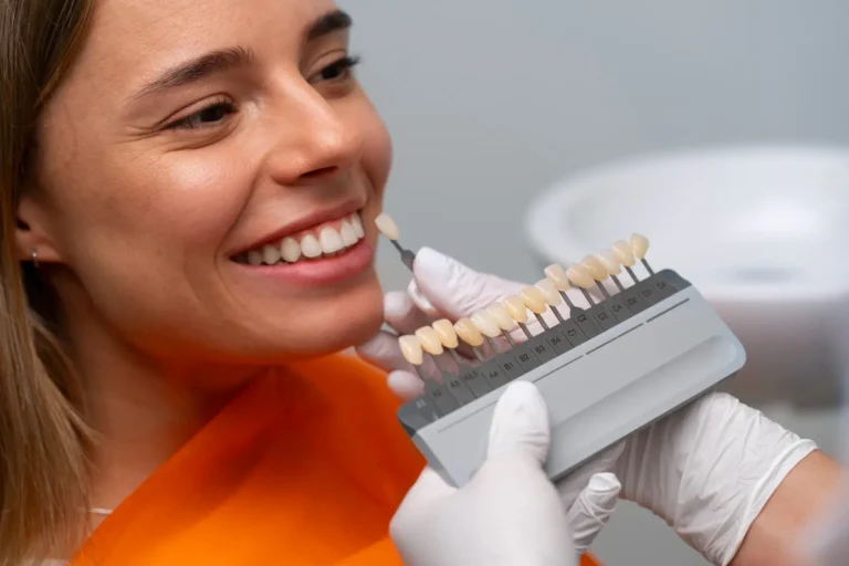 Veneers in Colombia Cost