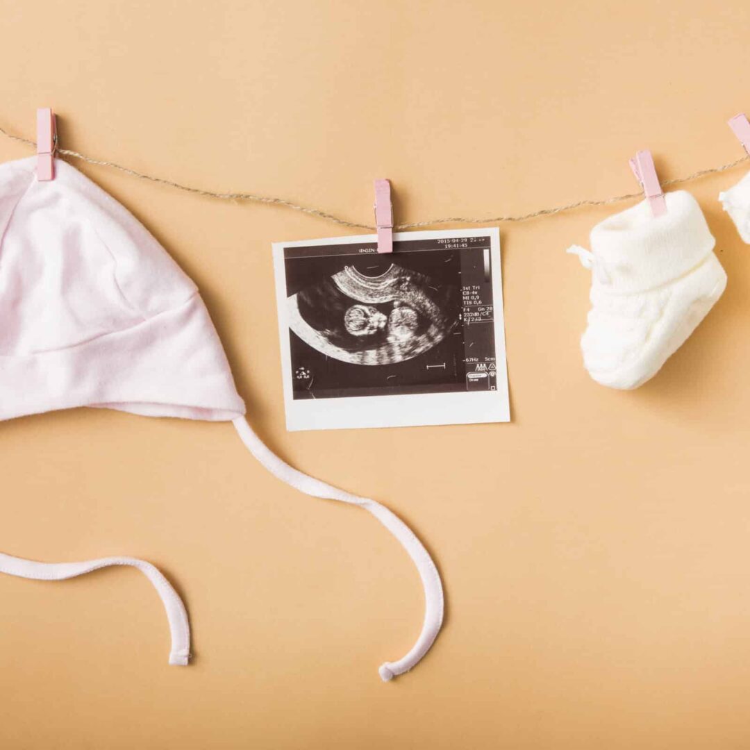 IVF in Greece Cost