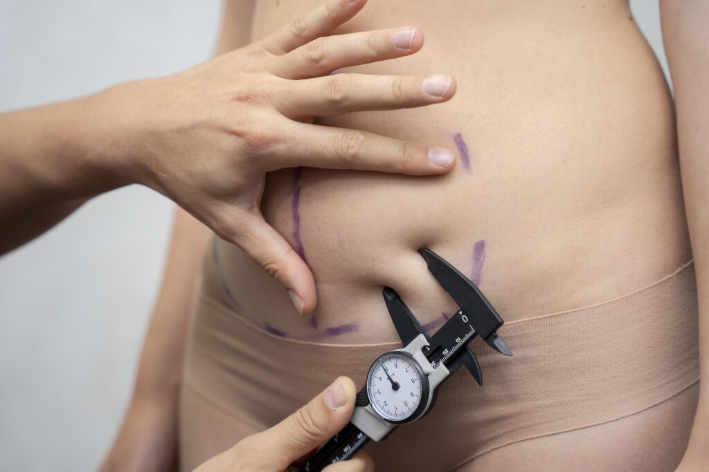 Gastric Sleeve Surgery