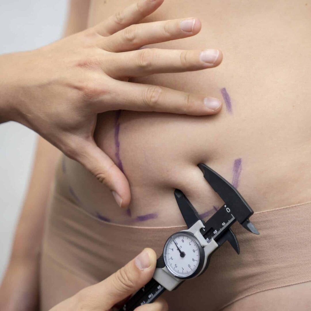 Gastric Sleeve Surgery in Turkey Cost