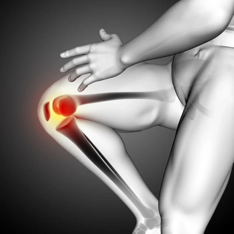 Total Knee Replacement Cost Without Insurance
