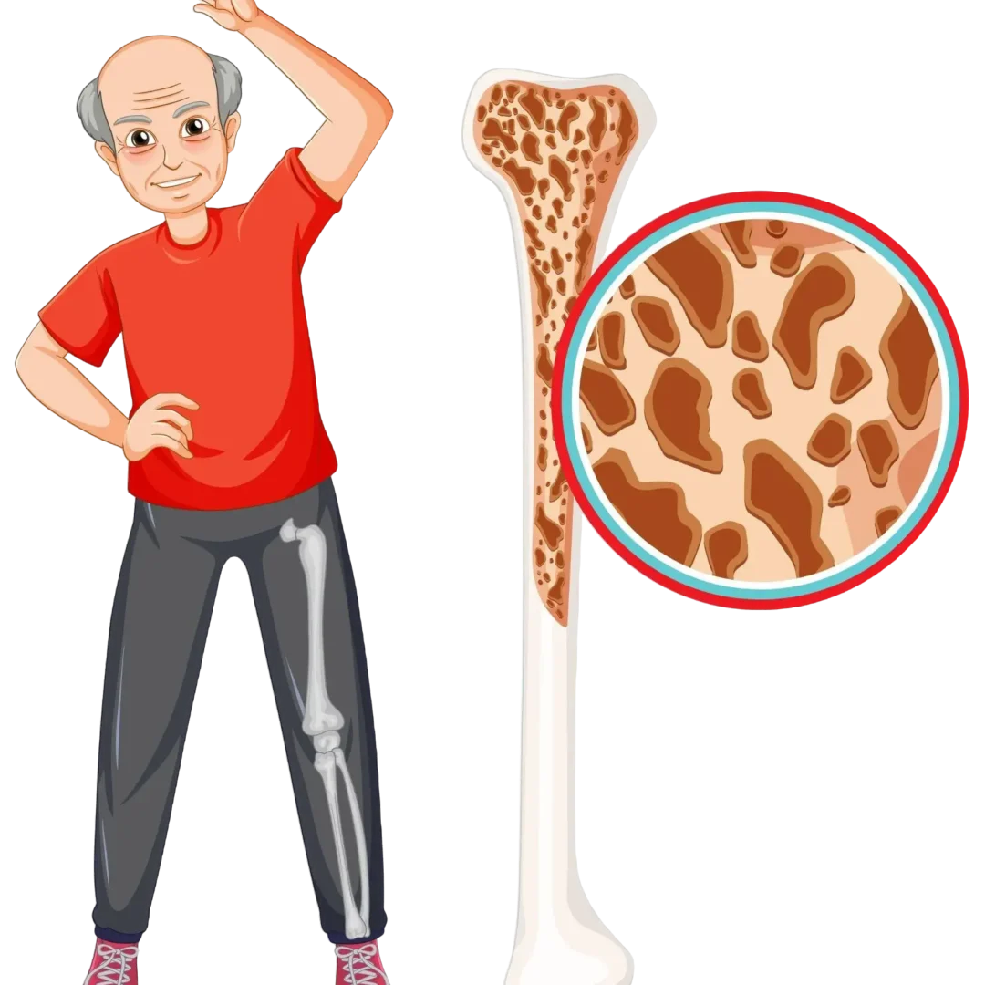 Best Countries for Bone Marrow Transplant in the World