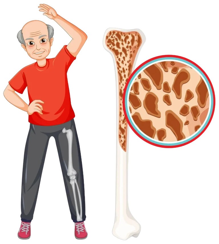 Best Countries for Bone Marrow Transplant in the World