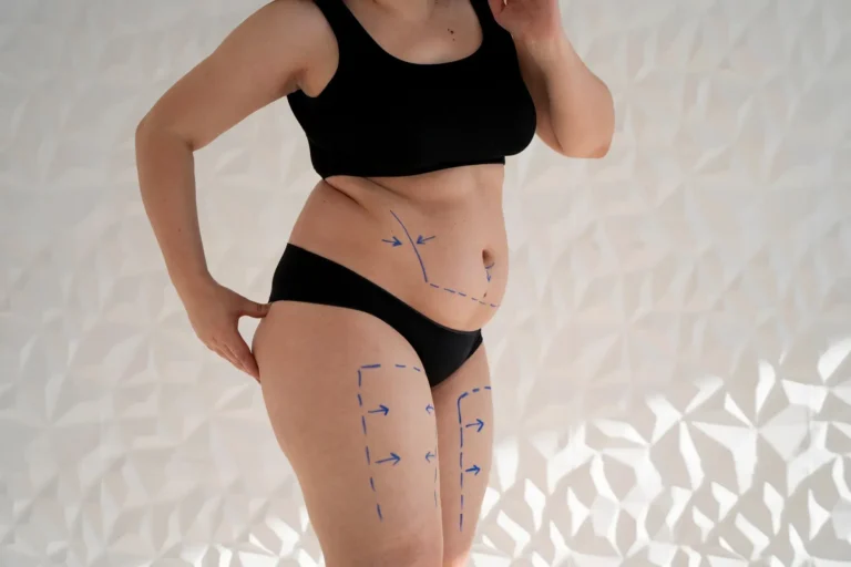 Liposuction in Thailand Cost - Full Body & 360 Lipo