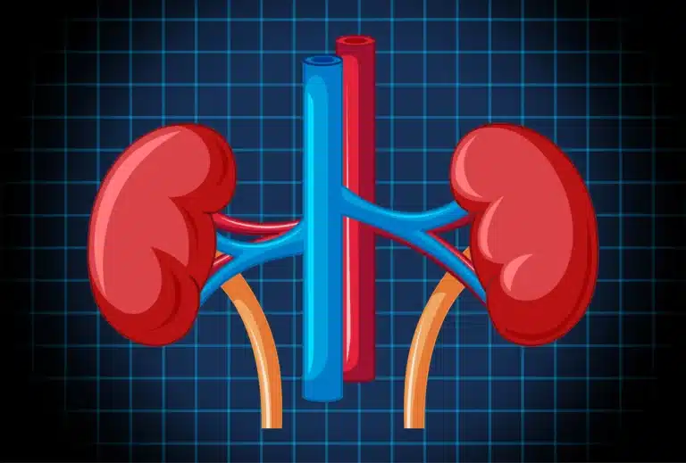best-countries-for-kidney-transplant-in-the-world