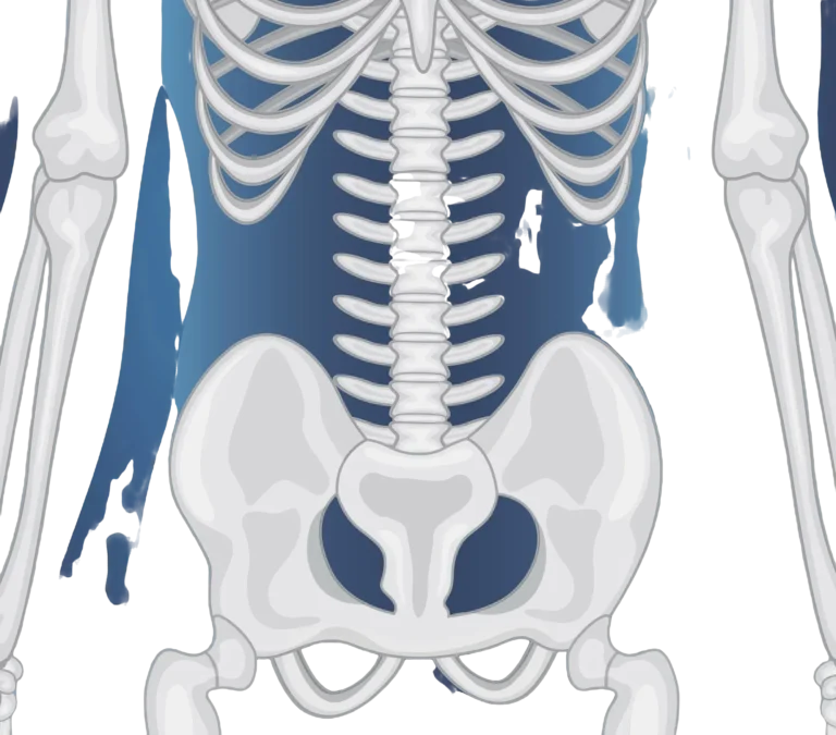 In Spain, the cost of hip replacement surgery