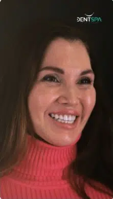 lavoro dentale in Turchia