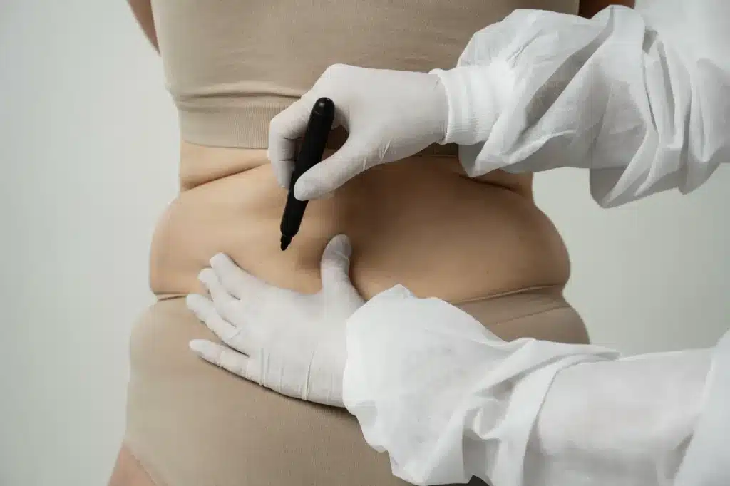 Air Sculpt Cost in Mexico with Clinics