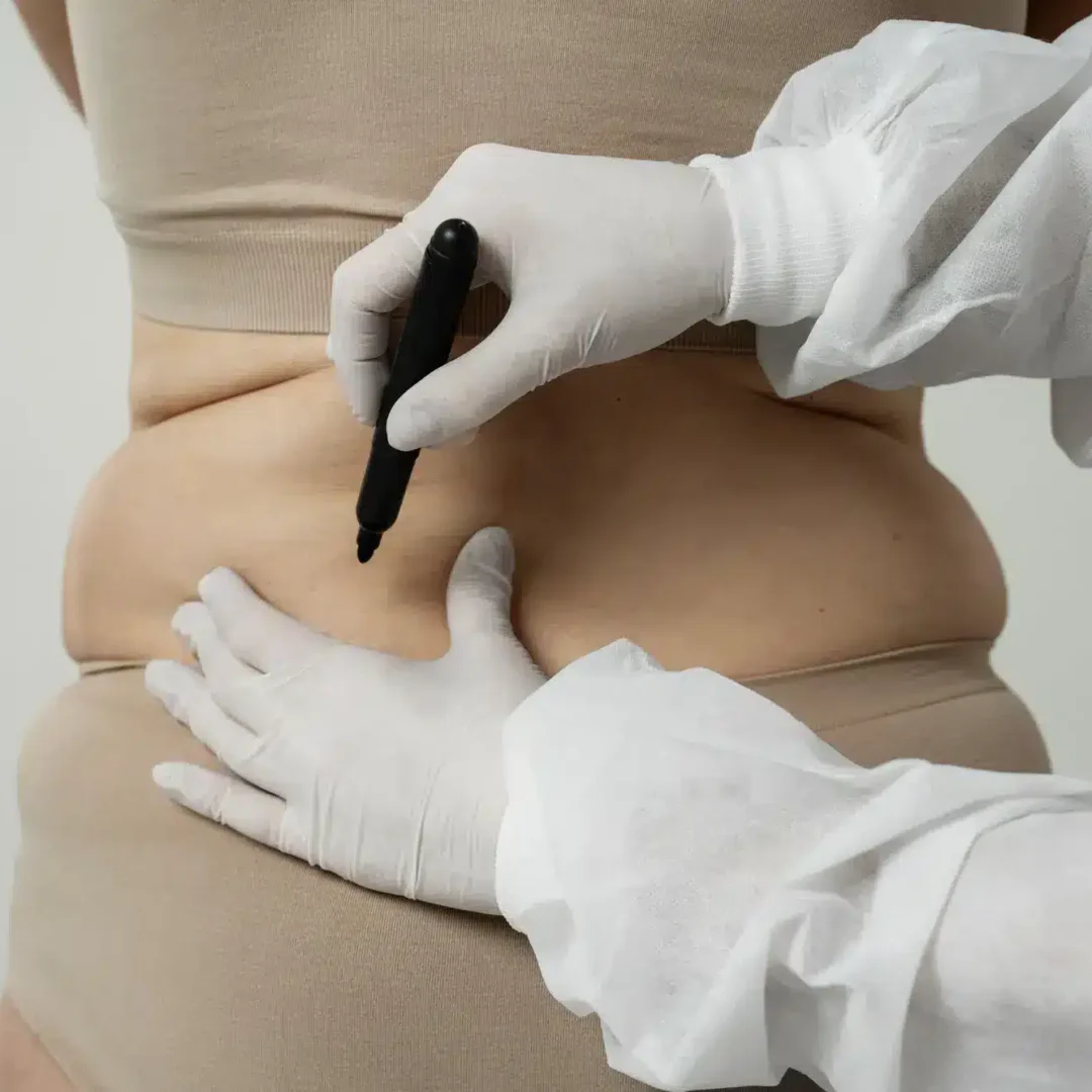 Air Sculpt Cost in Mexico with Clinics