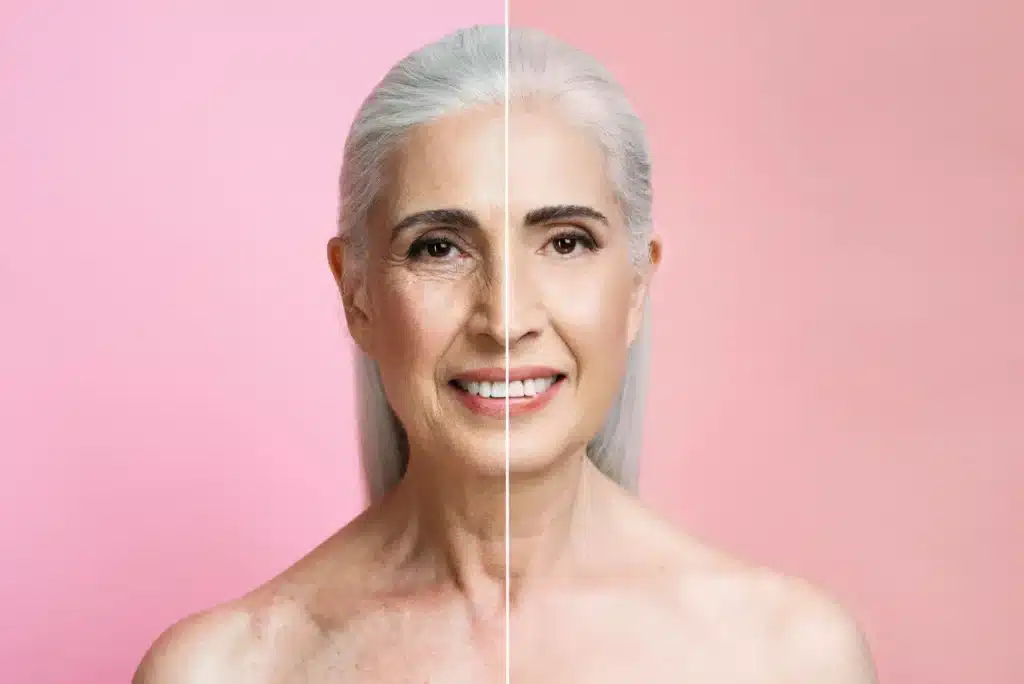 Facelift in Mexico Cost with Clinics