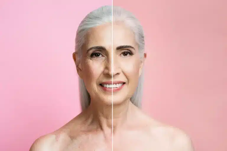 Facelift in Mexico Cost with Clinics
